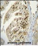PAPOLA Antibody in Immunohistochemistry (Paraffin) (IHC (P))