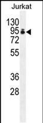 PAPOLA Antibody in Western Blot (WB)