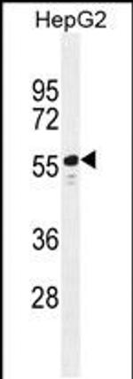 TTC6 Antibody in Western Blot (WB)