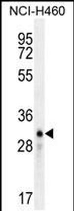 LCN9 Antibody in Western Blot (WB)