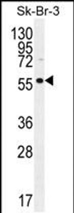 TRABD2A Antibody in Western Blot (WB)