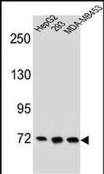 ZNF860 Antibody in Western Blot (WB)