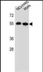 LRRC6 Antibody in Western Blot (WB)