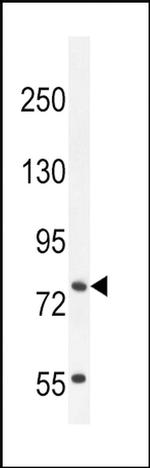 SLCO4C1 Antibody in Western Blot (WB)