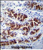 PTPN20A Antibody in Immunohistochemistry (Paraffin) (IHC (P))