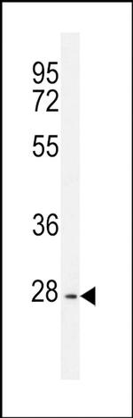 PTPN20A Antibody in Western Blot (WB)