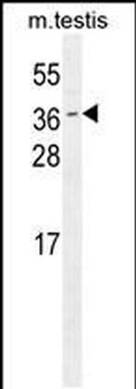 ODF3 Antibody in Western Blot (WB)