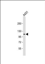 DIEXF Antibody in Western Blot (WB)