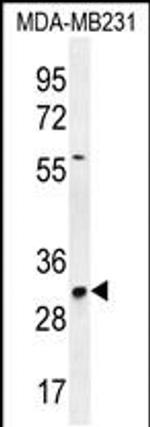 TNFAIP8L3 Antibody in Western Blot (WB)