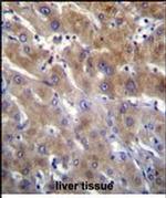 ANKRD18B Antibody in Immunohistochemistry (Paraffin) (IHC (P))