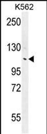 ANKRD18B Antibody in Western Blot (WB)