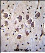 ANKRD34C Antibody in Immunohistochemistry (Paraffin) (IHC (P))