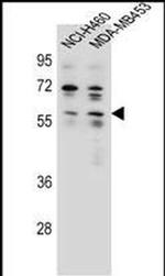 ANKRD34C Antibody in Western Blot (WB)