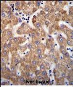 ANKRD58 Antibody in Immunohistochemistry (Paraffin) (IHC (P))