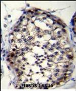 ROPN1L Antibody in Immunohistochemistry (Paraffin) (IHC (P))