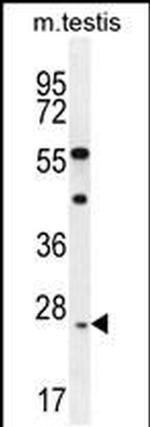 ROPN1L Antibody in Western Blot (WB)