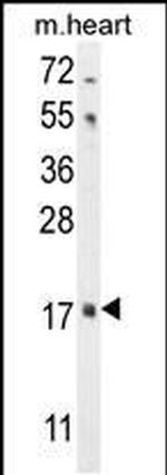 FGF16 Antibody in Western Blot (WB)