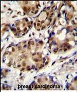 MNAR Antibody in Immunohistochemistry (Paraffin) (IHC (P))