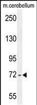 ZBTB24 Antibody in Western Blot (WB)