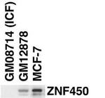 ZBTB24 Antibody in Western Blot (WB)