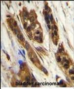 SNRNP27 Antibody in Immunohistochemistry (Paraffin) (IHC (P))