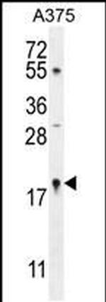 SNRNP27 Antibody in Western Blot (WB)