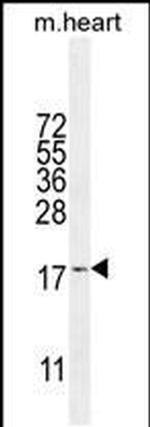SNRNP27 Antibody in Western Blot (WB)