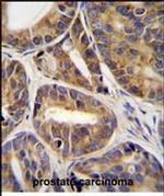 RNF215 Antibody in Immunohistochemistry (Paraffin) (IHC (P))