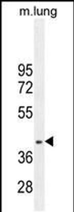 RNF215 Antibody in Western Blot (WB)