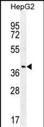 RNF215 Antibody in Western Blot (WB)