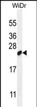 C19orf84 Antibody in Western Blot (WB)