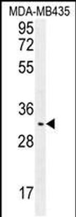 OR4K2 Antibody in Western Blot (WB)