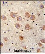 SKOR2 Antibody in Immunohistochemistry (Paraffin) (IHC (P))
