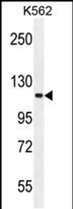 SKOR2 Antibody in Western Blot (WB)