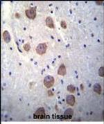 RGS7 Antibody in Immunohistochemistry (Paraffin) (IHC (P))