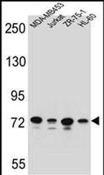 PCDHB15 Antibody in Western Blot (WB)
