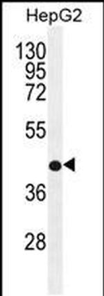 RDH13 Antibody in Western Blot (WB)