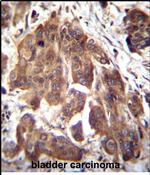 GLMN Antibody in Immunohistochemistry (Paraffin) (IHC (P))