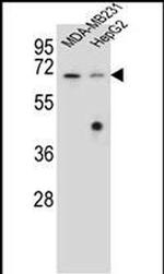 GLMN Antibody in Western Blot (WB)