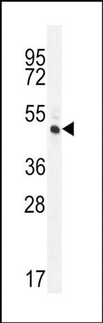 RINL Antibody in Western Blot (WB)
