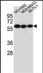 CHRNA10 Antibody in Western Blot (WB)