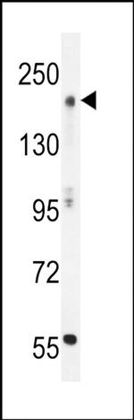 MOZ Antibody in Western Blot (WB)