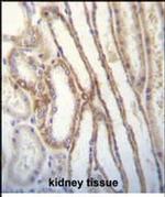 MYO3B Antibody in Immunohistochemistry (Paraffin) (IHC (P))