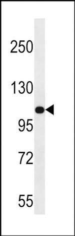 MYO3B Antibody in Western Blot (WB)