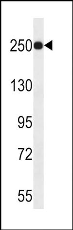 KDM5A Antibody in Western Blot (WB)