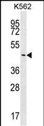 PLCXD2 Antibody in Western Blot (WB)