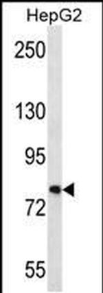 FNDC7 Antibody in Western Blot (WB)