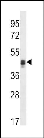 Calumenin Antibody in Western Blot (WB)