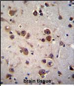 CHST6 Antibody in Immunohistochemistry (Paraffin) (IHC (P))