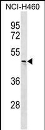 CHST6 Antibody in Western Blot (WB)